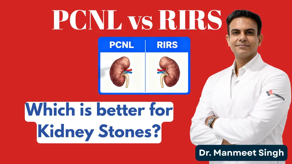 PCNL vs RIRS Kidney Stone Surgery - Dr Manmeet Singh Lucknow